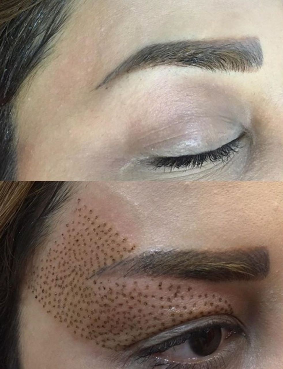 آموزش پلکسر،میکرونیدل،مزوتراپی،ژل و بوتاکس،کاشت ناخن، لیزر موهای زاید