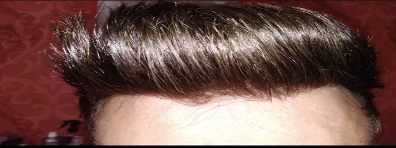 مرکز تخصصی ترمیم مو رئا